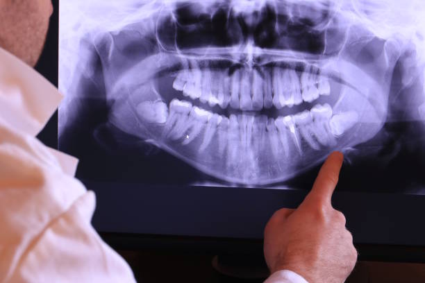 Best Tooth Pain Emergency Relief  in North Puyallup, WA